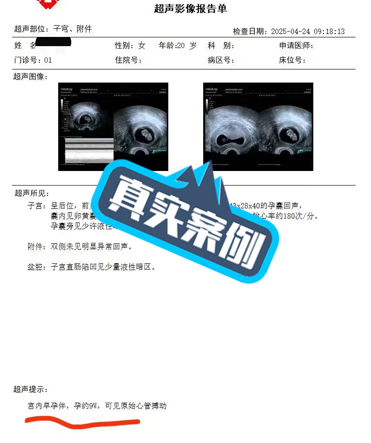 四月再添好孕气！ 生娃趁早幸福享早-第1张图片